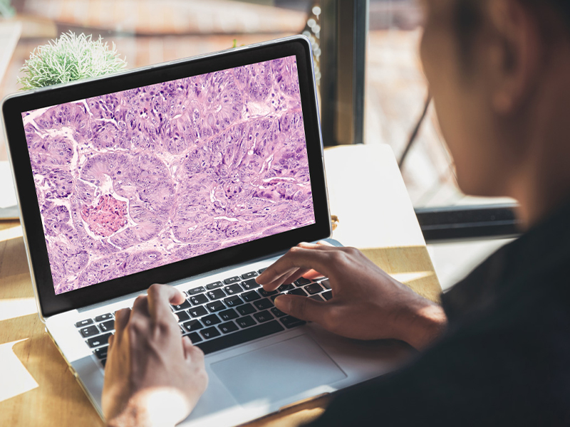 Woman looking down at a laptop with a cell image displayed