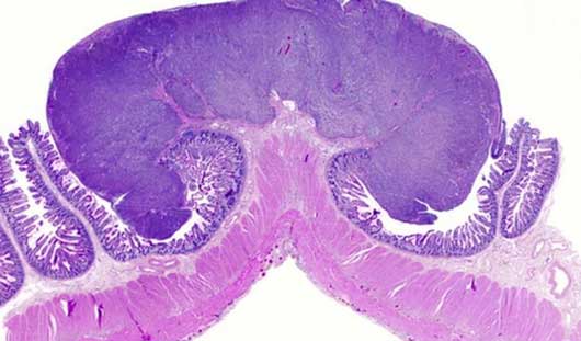 small-bowel